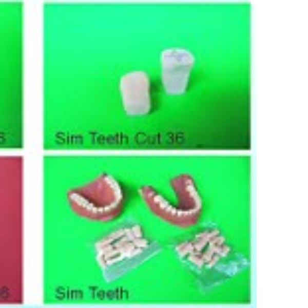 หุ่นจำลองซี่ฟันสภาวะต่างๆ